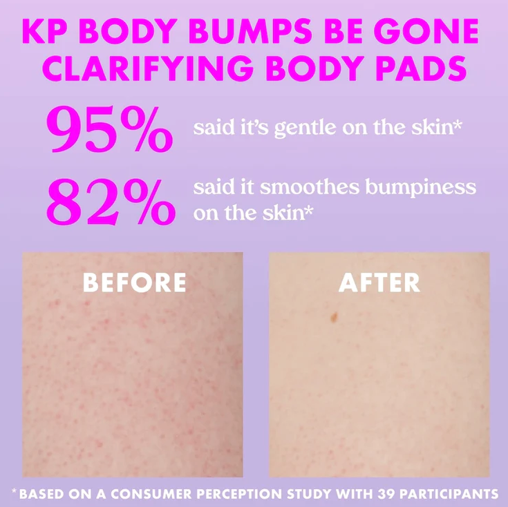 Body Bumps Be Gone Pads